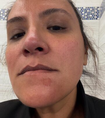 After a dental episode, an odd self-scratch amuses her in a shockingly funny twist. 