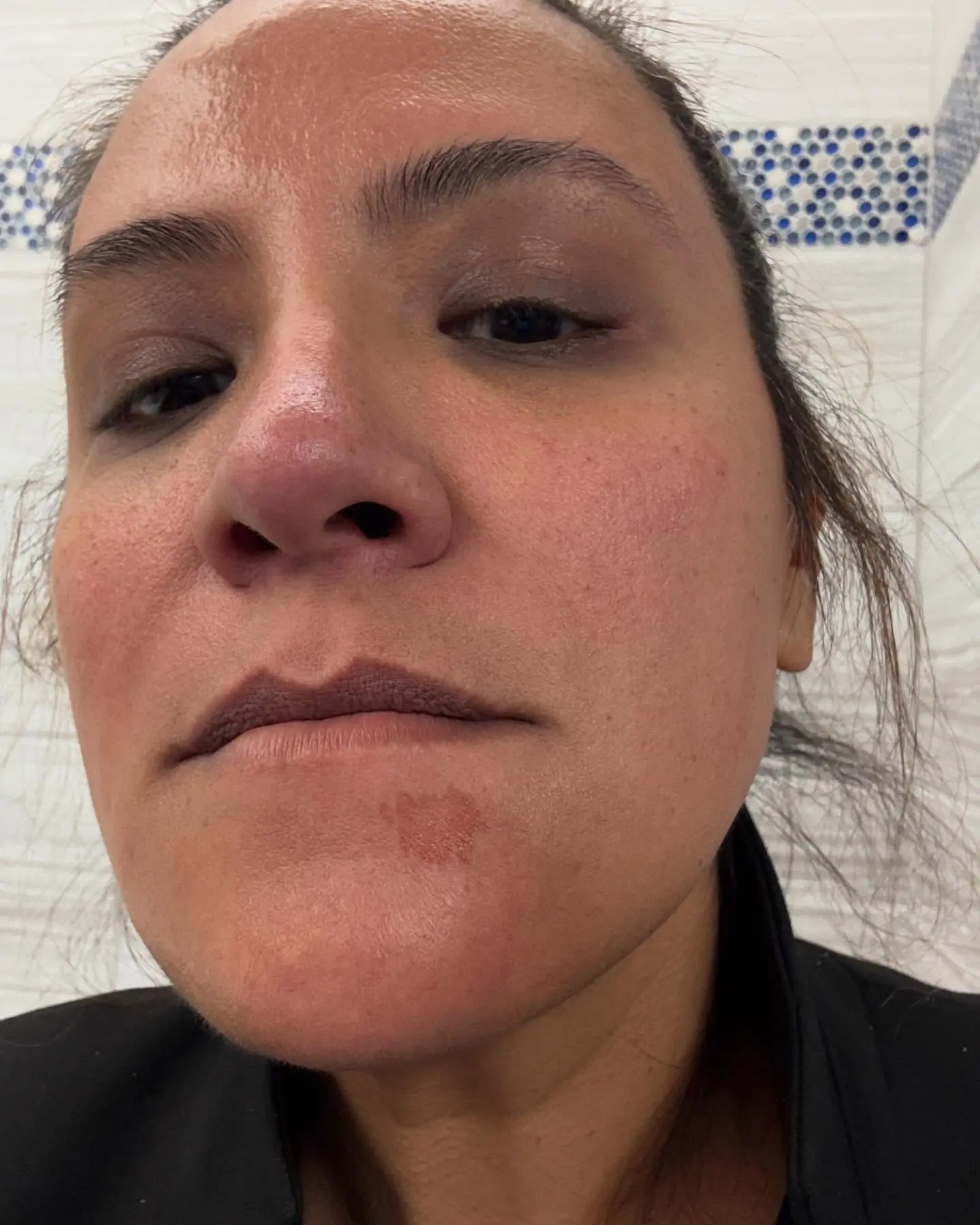 Cristela Alonzo’s Numb-Face Dental Fiasco After a dental episode, an odd self-scratch amuses her in a shockingly funny twist.