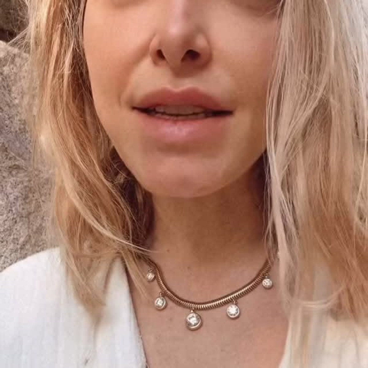 Jenny Mollen’s Colonoscopy Post: Avocado Toast Humor Celebrity food blogger Jenny Mollen mixes colonoscopy insights with snack moments.