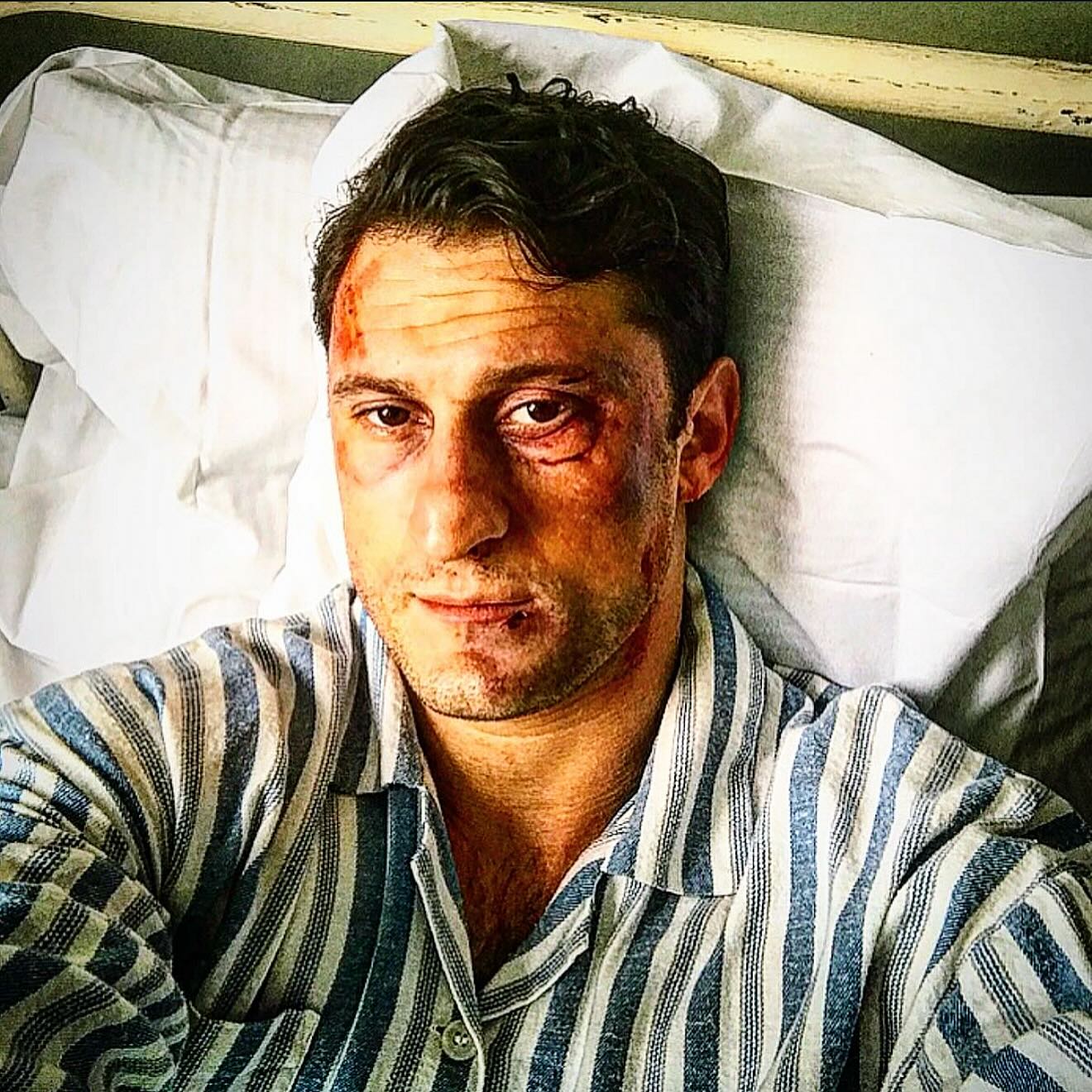 Josh Meyers Endures Harsh On-Set Fight Scene Skilled thespian tackles a rugged stunt, showcasing determination and pure authenticity!!!