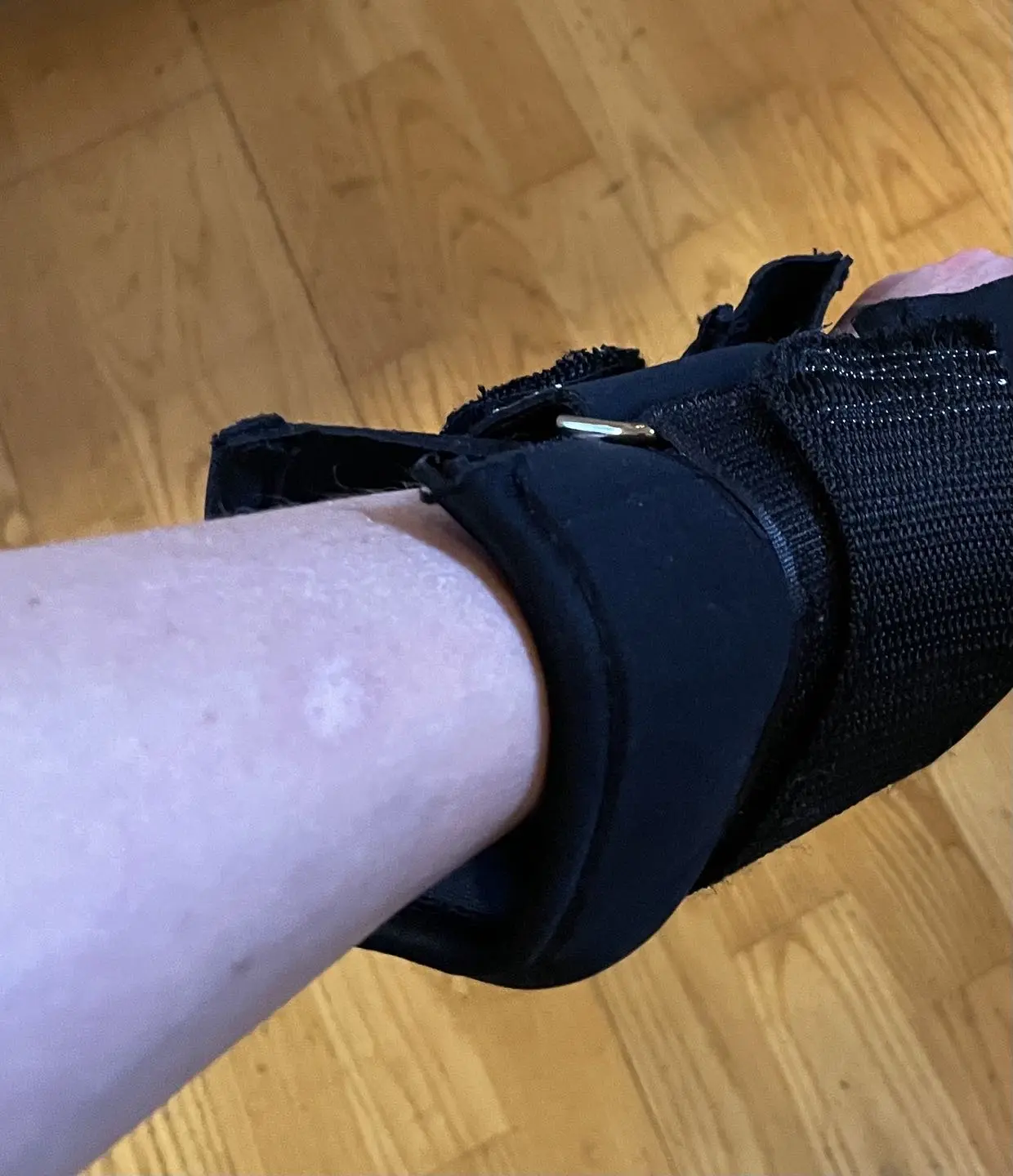 Paget Brewster Posts Cooking Burn Photo Instagram's latest share captures a celebrity kitchen oops with a minor sizzling skin mark