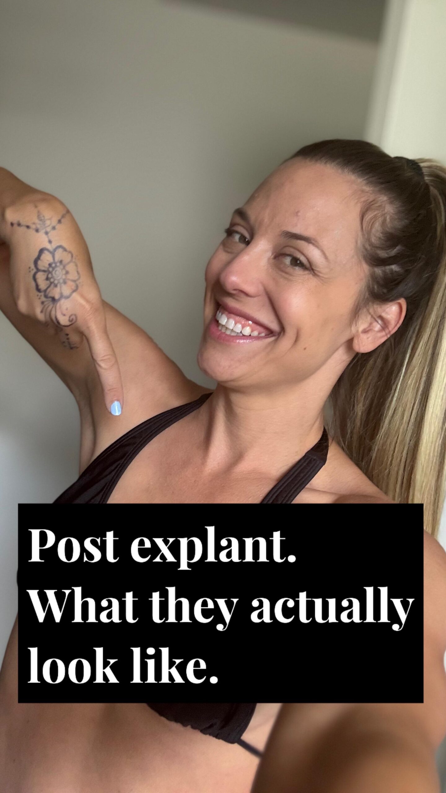 Taryn Terrell Opens Up About Recovery Journey After Explant Surgery Empowering update on natural recovery, offering hope to women battling implant illness!!!